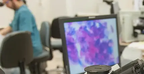 Análisis de imagen mediante telepatología La telepatología permite la transmisión a distancia de imágenes de muestras patológicas con fines de consulta o diagnóstico.<br/><br/>